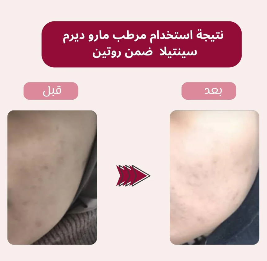 كريم الترطيب والتهدئة بسنتيلا من ماروديرم – ٢٠٠ مل